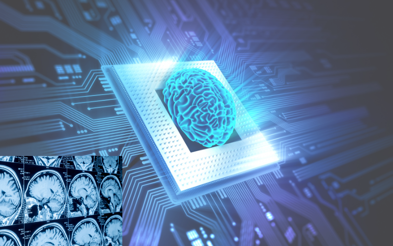 brain as switchboard-bidrentional neuronal connections
